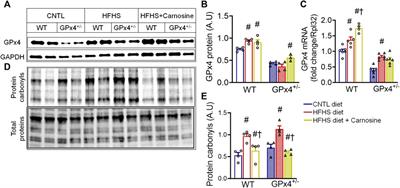 Iron scavenging and suppression of collagen cross-linking underlie antifibrotic effects of carnosine in the heart with obesity